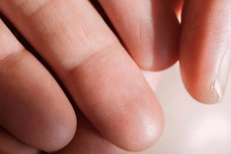 Close-up of the ridge pattern on a person's fingertips
